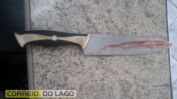 A vítima apresentava duas perfurações na perna e foi levada para o PAM, sem risco à vida (Foto: Correio do Lago )