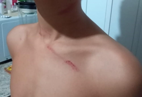 Menino foi agredido em Campo Mourão — Foto: Arquivo pessoal