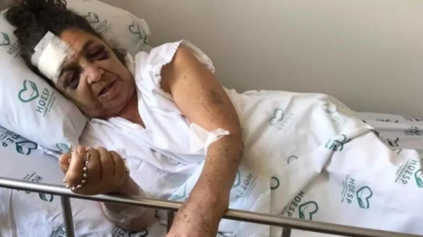 Devido ao forte impacto, ela precisou ficar internada na UTI. Foto: Arquivo familiar