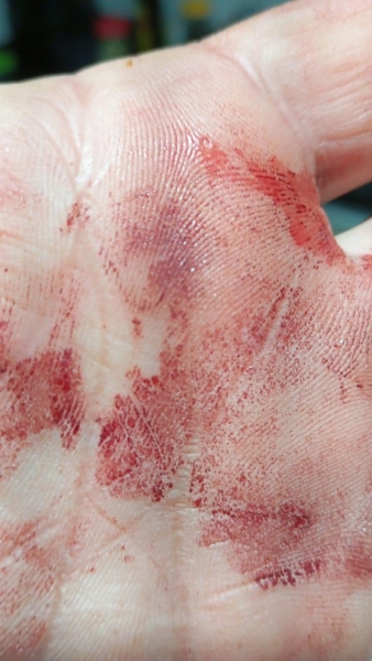 Uma das mãos da vítima que tem sangue dos ferimentos próximos aos olhos. Foto: Divulgação.